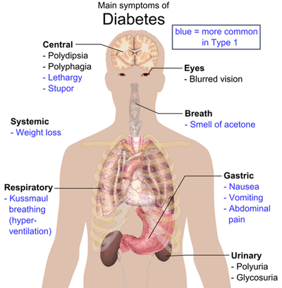 diabetes symptomen